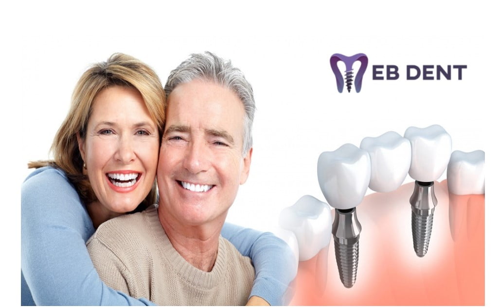 Afla ce este si ce presupune un implant dentar!