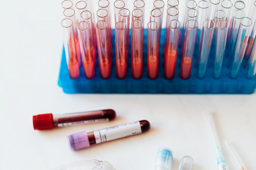 Top 7 situații în care va fi nevoie să efectuezi analize medicale
